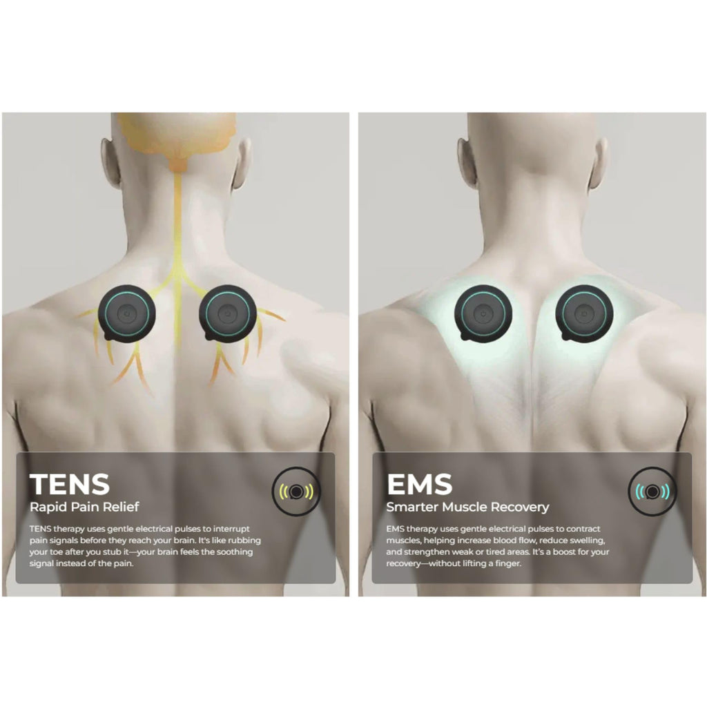 CHIRP Halo Wireless Muscle Stimulator - Portable EMS Device